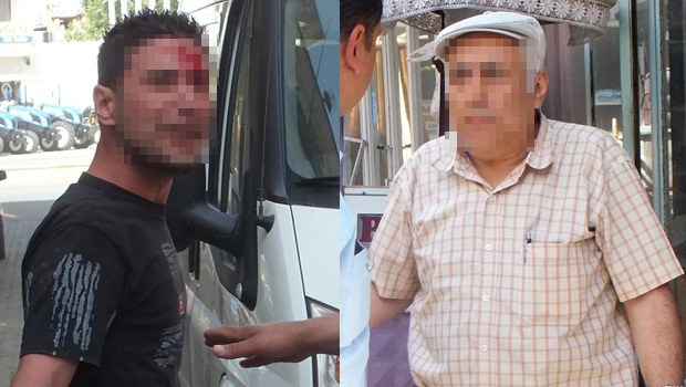 Yanağından makas aldı, sandalyeyi yedi!